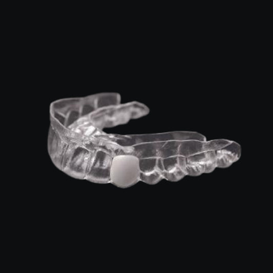 Essix Retainer