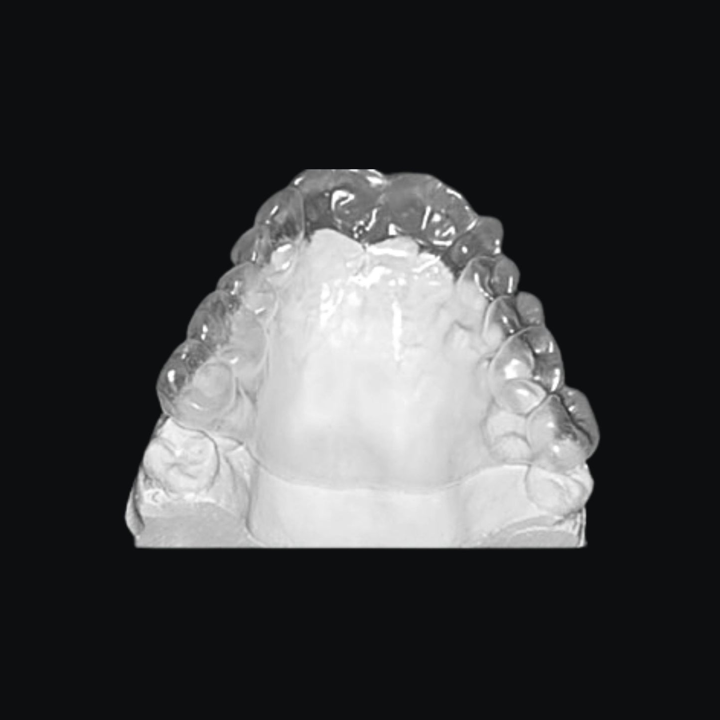 Palatal Stent