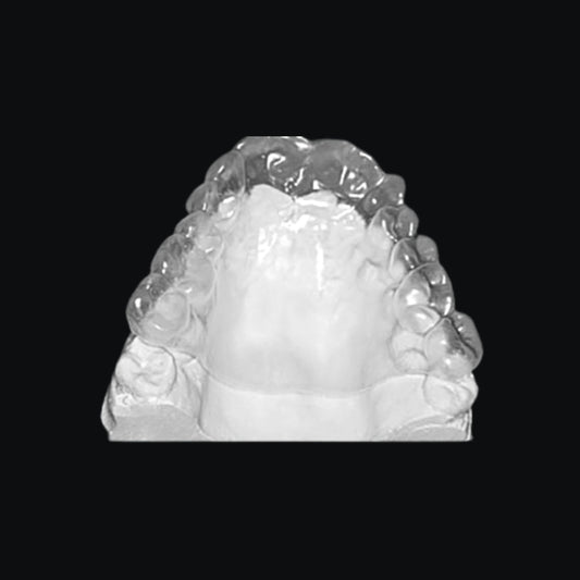 Palatal Stent