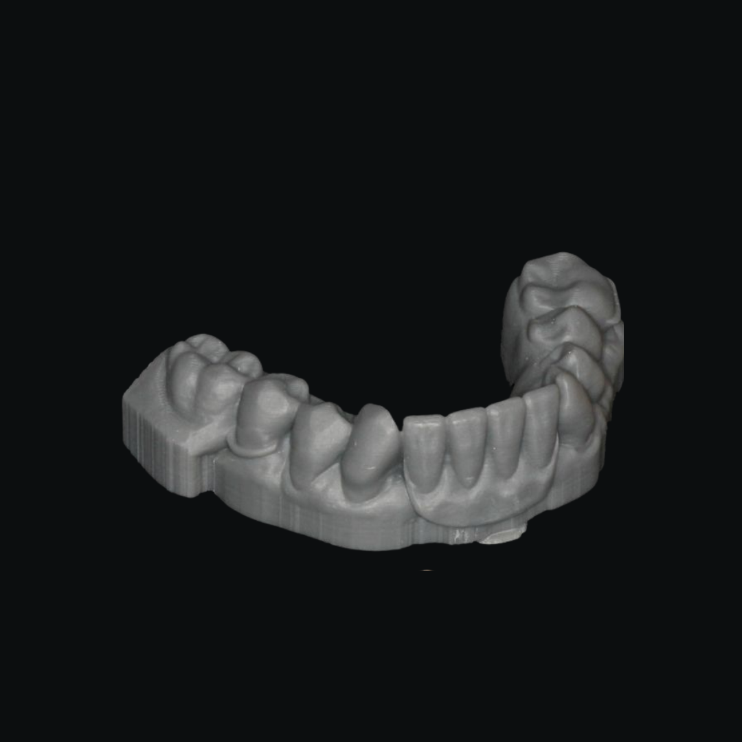 Study Model