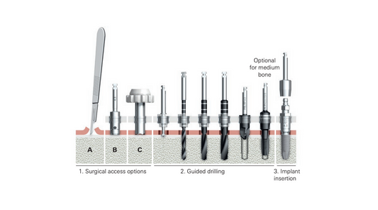 8 Surgical Guide Design Considerations for Nobel Parallel Conical Connection